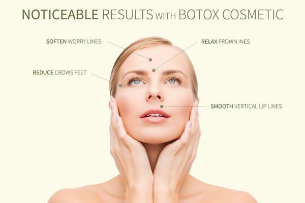 Botox