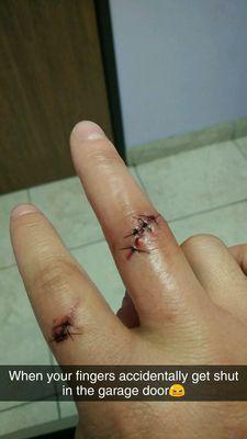 Had my fingers smashed in a door almost to the bone, and they were able to see to it right away.Friendly and informative staff 4Llacerations