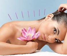 Neck, shoulder needle treatment can be relax/reduce the local muscle tension/tightness, anxiety, depression & stress