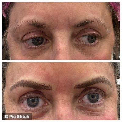 Microblading