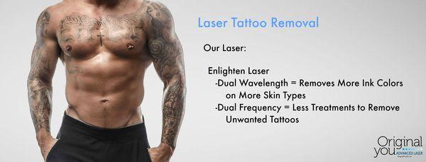 Advance Laser Tattoo Removal