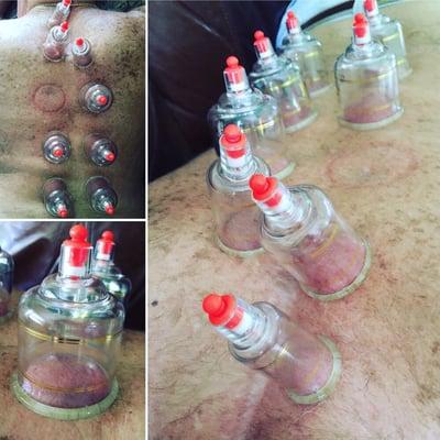 Cupping Therapy, great addition to a deep tissue massage!