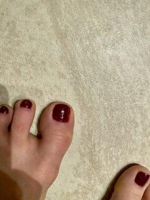 Bleeding toes (3)