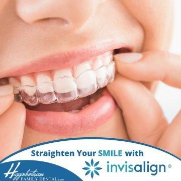 Straighten your smile with Invisalign!