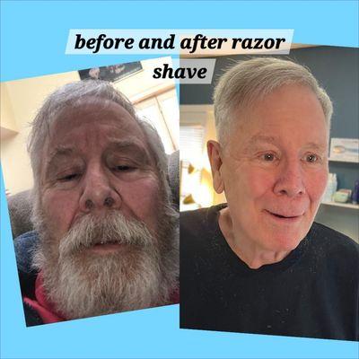 Before and after for a face shave! Did not do the cut, just the razor facial shave.