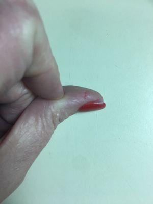 The cut on my thumb