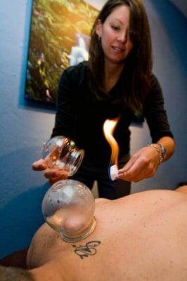 Fire Cupping is a non-needle technique to treat pain and injury and to improve circulation.