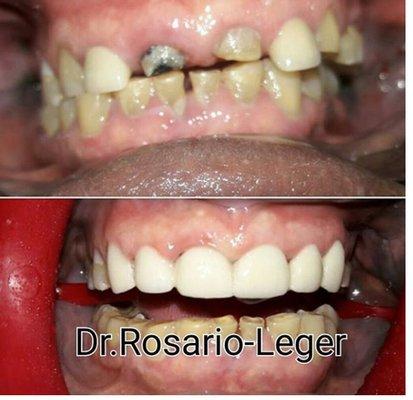 Dellanira Rosario Leger Dentistry PC