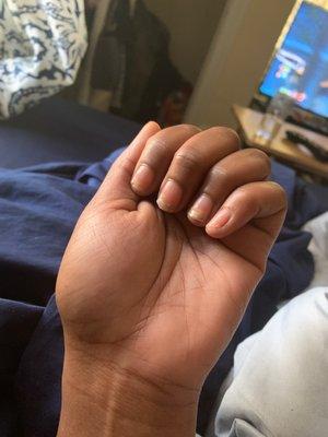 My left hand she damage badly I can't my nails done like I always do every few weeks because of her damage I want to sue