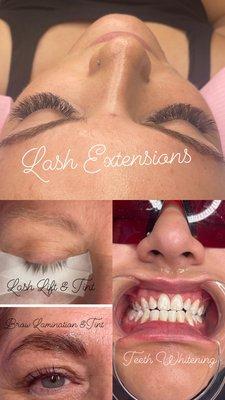 Lash extensions, brow lamination, brow tint, lash lift, lash tint, teeth whitening