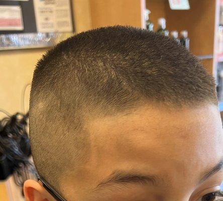 Terrible edge up on a 10 year old little boy