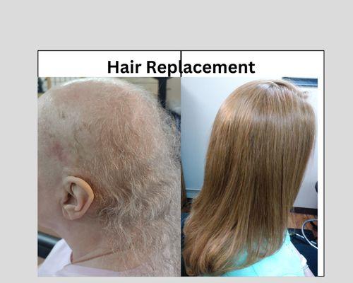 Hairoots Hair Replacement  LLC