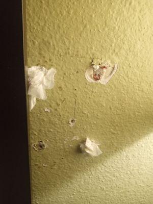 This is bloody tissue in the wall