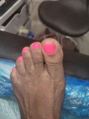 Gel pedicure that look like a 3 year old did it