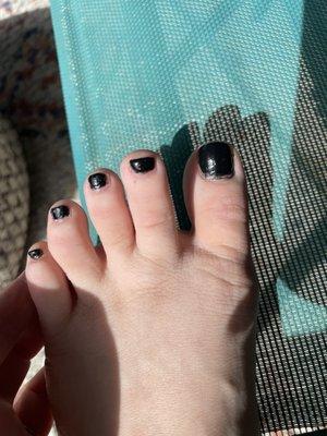 Horrible pedicure