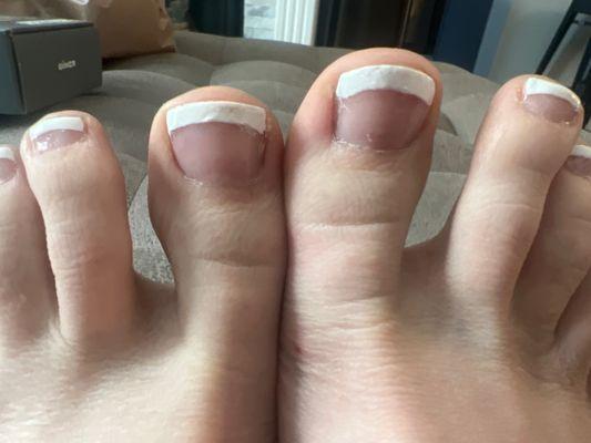 Bad French pedicure job