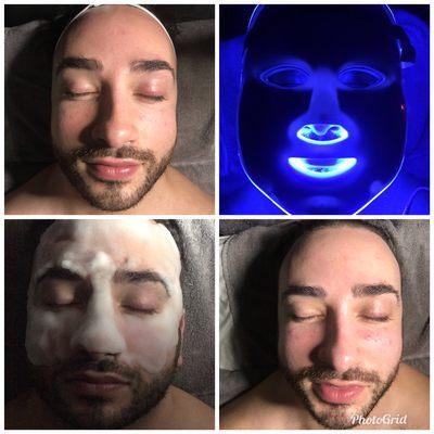 Champagne facial, Men need self care too!