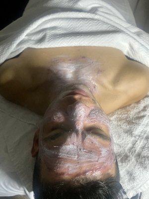 Customized male facial for congested skin