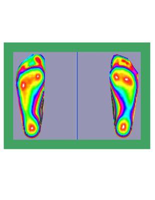 3D scanning, non contact-non weight bearing.