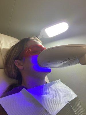 Teeth Whitening