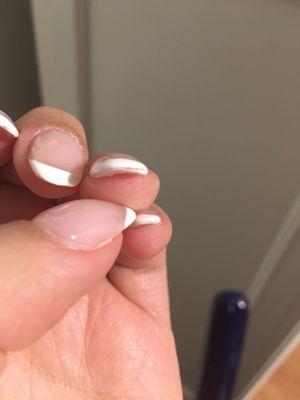 Paint missing from the nail