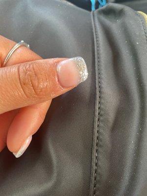 If you zoom in you can see the small particle of hair and my cuticle which was injured.