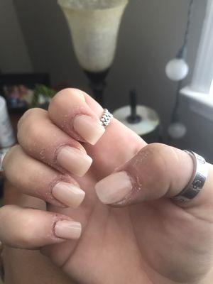 My nails after they used the sander on my fingers