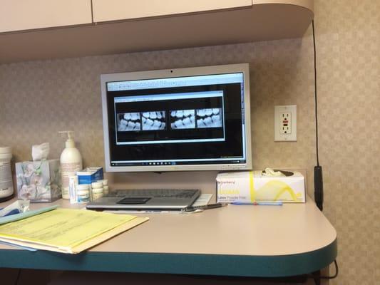 My X-Rays on the screen while I am still in the chair.