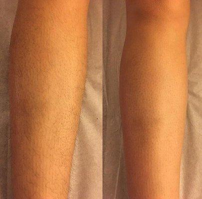 Before and after leg wax