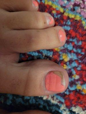 Pedi after barely 7 days....unbelievable. I could get my polish to stay on longer. What a rip