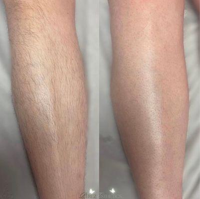 Before & after leg wax