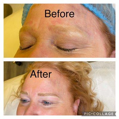 Microblading hair strokes