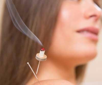 Moxibustion