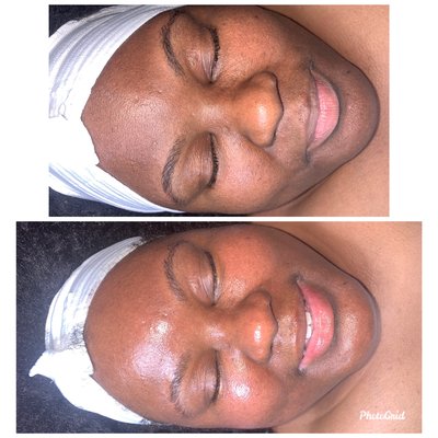 Brightening Facial Treatment