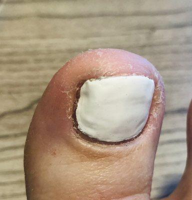 Deluxe pedicure result :(