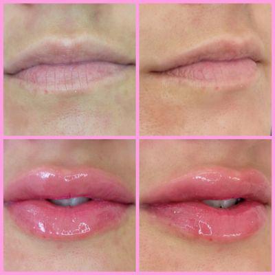 Lip Blush is a semi-permanent makeup option good for anyone who would like to enhance the look of their lips with color.