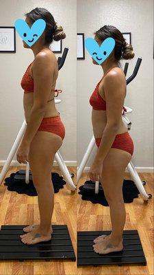 Posture improvement is a huge benefit of wrapping