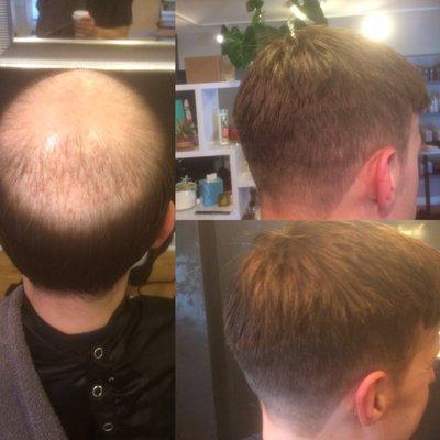 Men's Hair Replacement at Salon Juan.