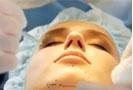 Cellulaze Neck Treatment