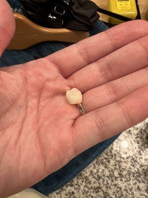 Tooth 18