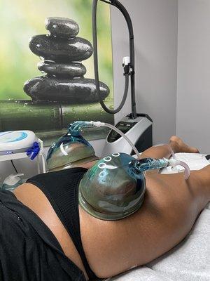 Non invasive vacuum butt therapy