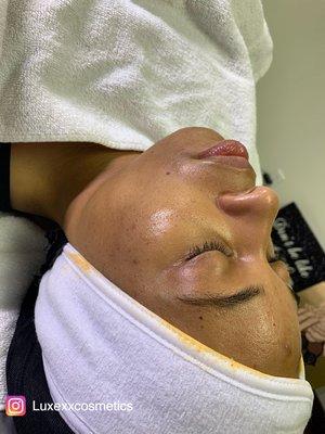 Deluxe facial!