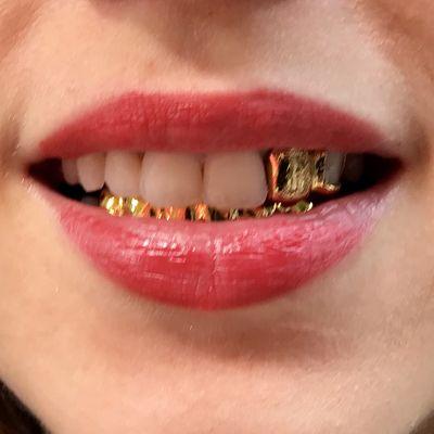 Gold Teeth Grillz