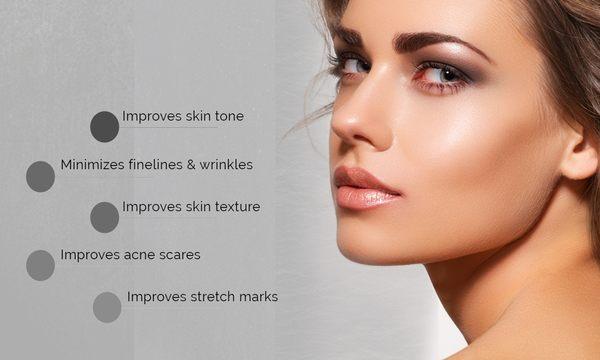 Advantages of Microneedling