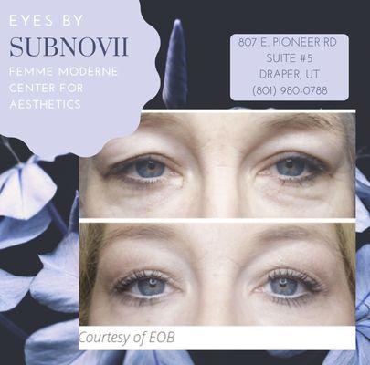 Subnovii anti-aging and skin tightening treatment