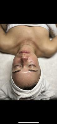 HydroFacial