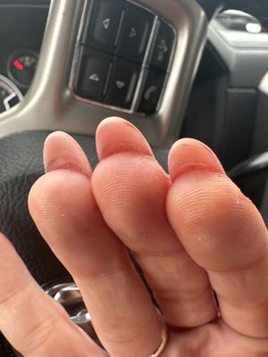 Underneath nail