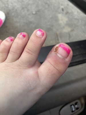 toe