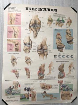 A few examples of what's causing the pain