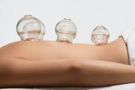 Massage Cupping